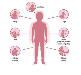 Symptoms of an respiratory syncytial virus infection