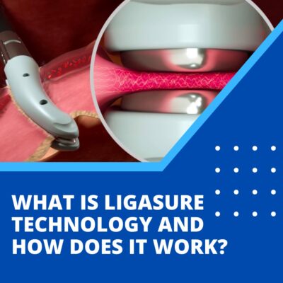 What is LigaSure technology and how does it work