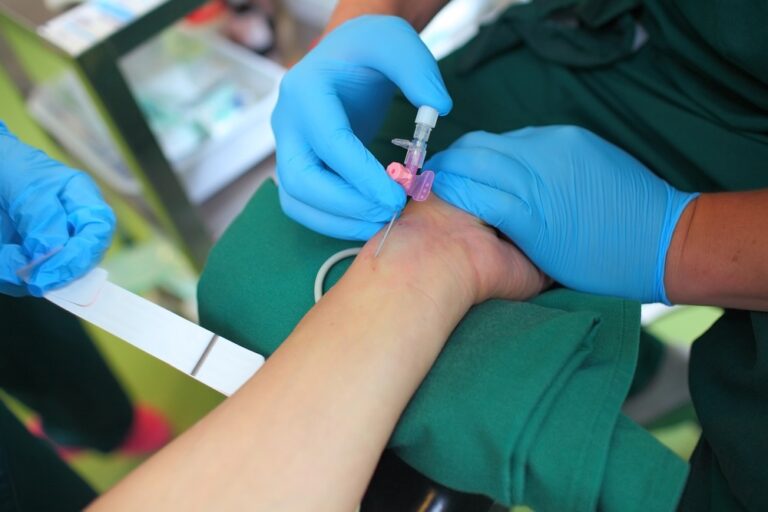 How to Measure Blood Pressure using an Arterial Catheter?