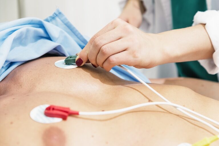 What are ECG electrodes and how to use them?
