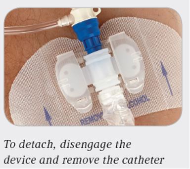 What Is The Statlock Stabilization Device And How Does It Work?