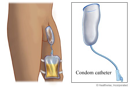 Condom catheter set
