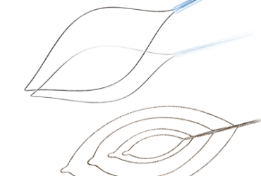 ConMed Orbit-Snare Rotatable Polypectomy Snare 10/CS