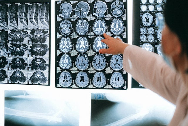 A physician diagnosing essential tremor based on brain scans