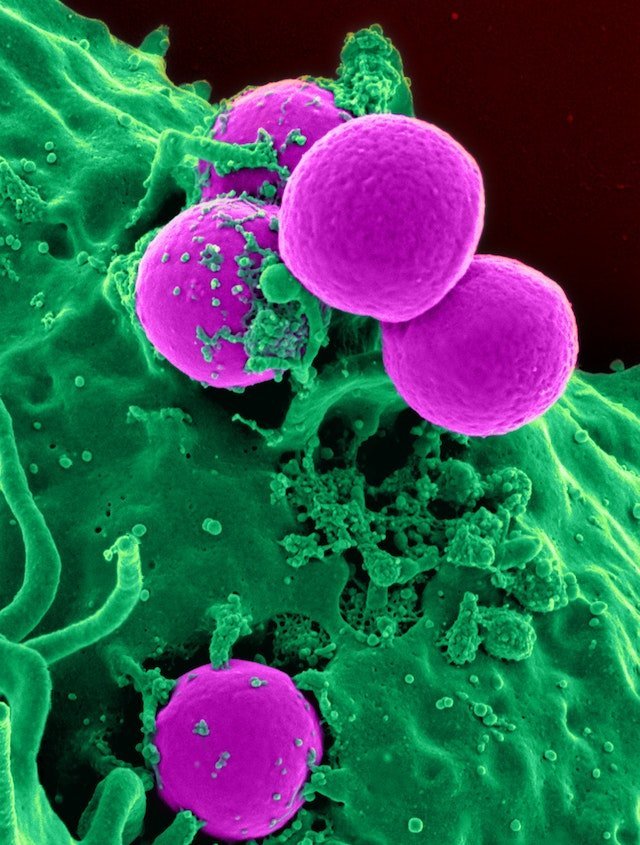 Microbes attacking the body