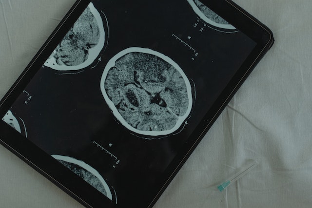 A brain scan is taken by employing medical imaging techniques