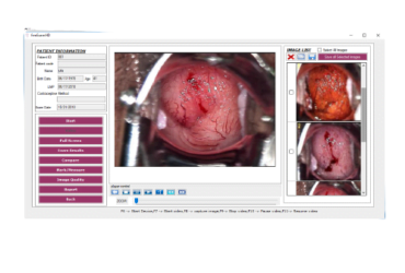 MedGyn 010477 Image and Data Management Software EACH