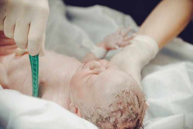 A physician taking necessary measurements of a newborn