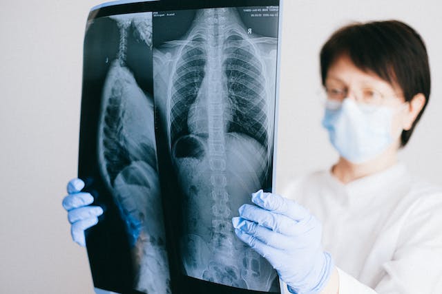 A healthcare professional analyzes lung scans to evaluate the presence of COPD