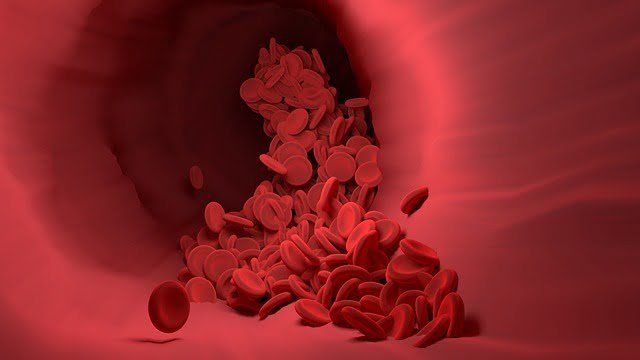 Blood cells clustering together to form clots