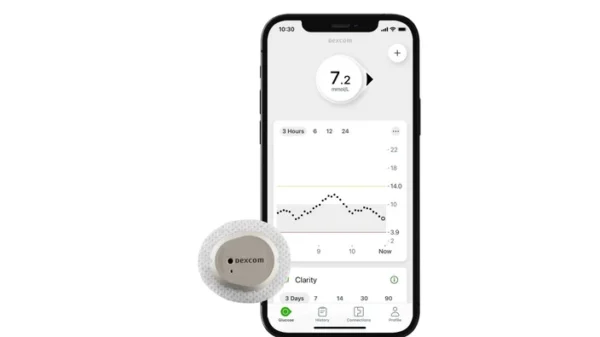 dexcom g7 sensor apple iphone 7.2 mmol