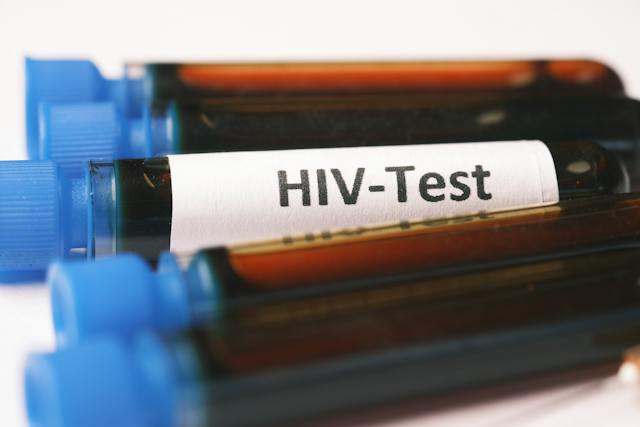Samples for laboratory-based HIV testing