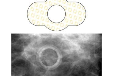 SDG-M612	MARKER, SKIN READIOPAQUE SPEE-D (100/BX)