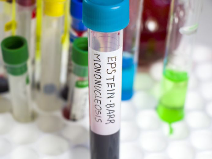 a blood sample prepared for testing for the Epstein-Barr virus, commonly associated with Mononucleosis