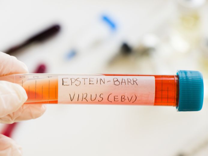 Blood samples collected for the detection of Epstein-Barr virus in a patient