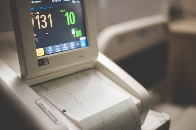 An electrocardiogram being printed after testing