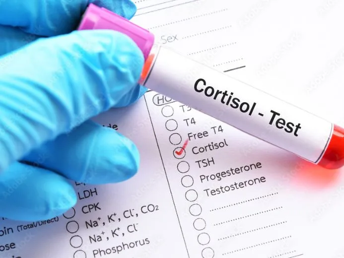 blood cortisol levels