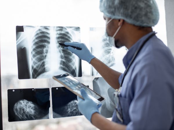 A healthcare professional is evaluating a chest X-ray for the diagnosis of the possible causes of dyspnea