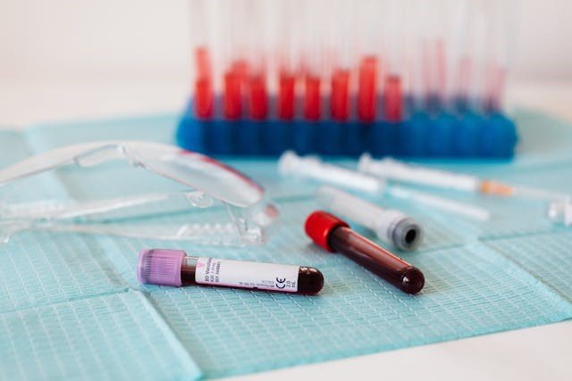 Vacutainer tubes protect the samples and reduce the risk of specimen spillage