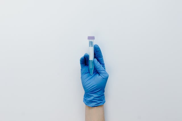 Vacutainers are tightly closed systems and reduce the risk of specimen spillage
