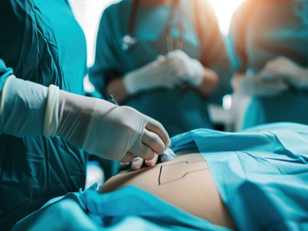 Plastic surgery is being conducted on a patient