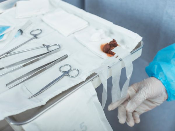 A suture kit is being employed during a surgical procedure
