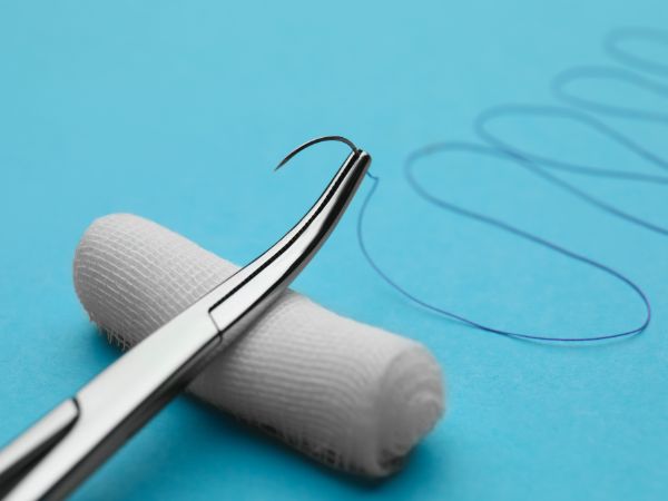 Suture kits have sharp and strong scissors for cutting the suture thread