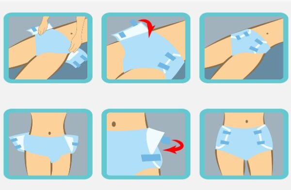 A step-by-step guide showing the donning process of adult diapers