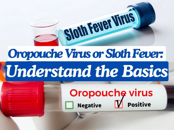 Oropouche Virus or Sloth Fever: Understand the Basics