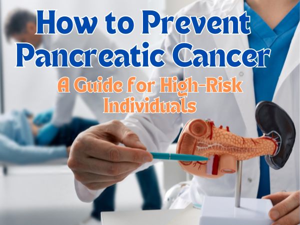 How to Prevent Pancreatic Cancer: A Guide for High-Risk Individuals