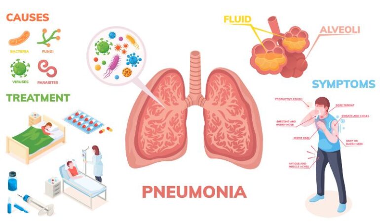 Causes and symptoms of pneumonia