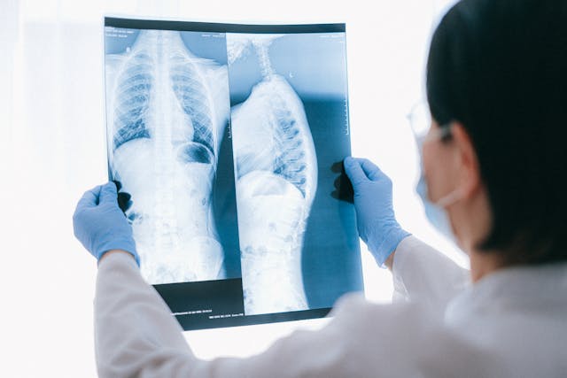 Chest X-ray confirms the presence or absence of pneumonia