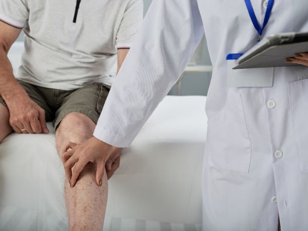 Knee arthritis often progresses in the thigh bone as well