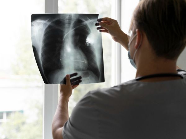 Lung scan helps in indicating the presence of cancerous mass