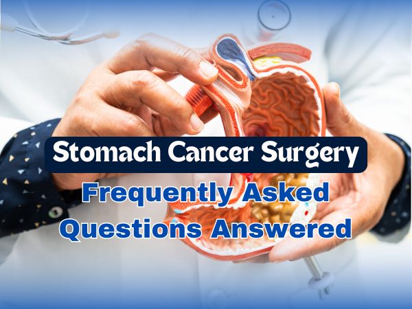 Stomach Cancer Surgery: Frequently Asked Questions Answered