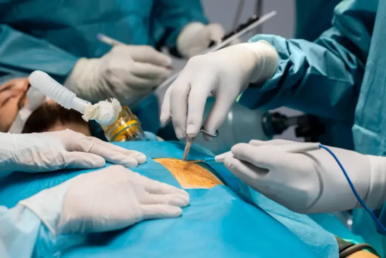 Stomach cancer surgery has a survival rate of 99%