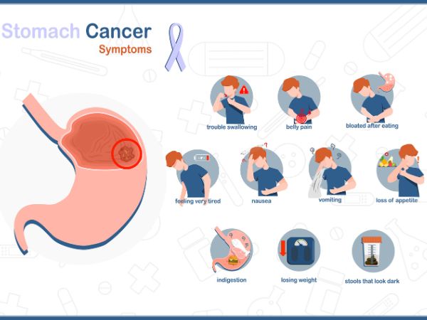 Symptoms associated with stomach cancer