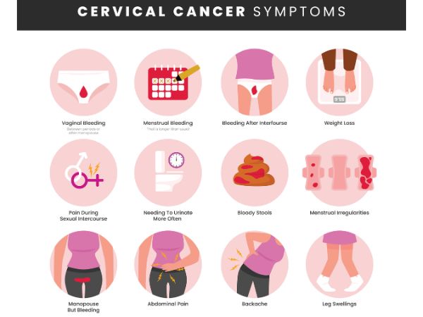 Symptoms of cervical cancer