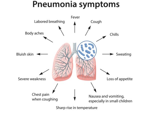 Symptoms of viral pneumonia