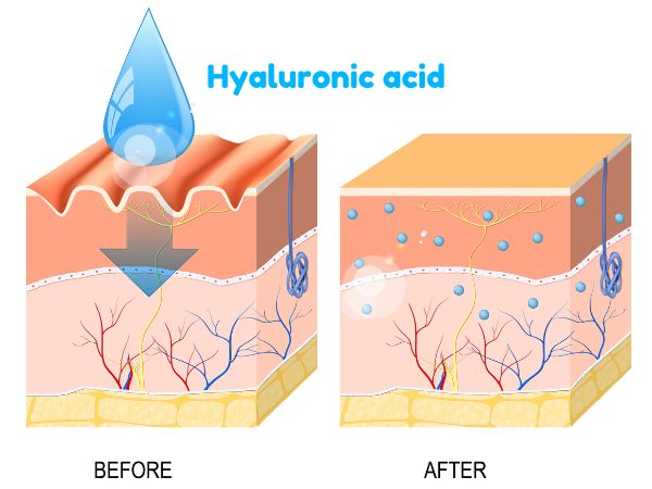 Best hyaluronic acid products with suitable molecular weight easily penetrate the skin barrier to provide an immediate plumping effect