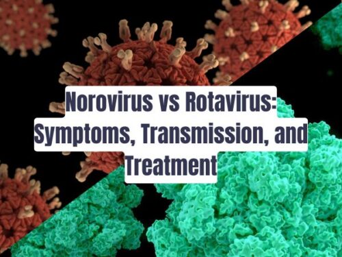 Norovirus vs Rotavirus: Symptoms, Transmission, and Treatment