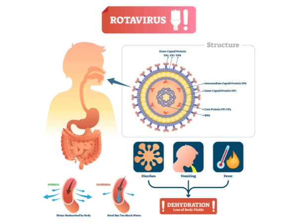 Symptoms of rotavirus infection