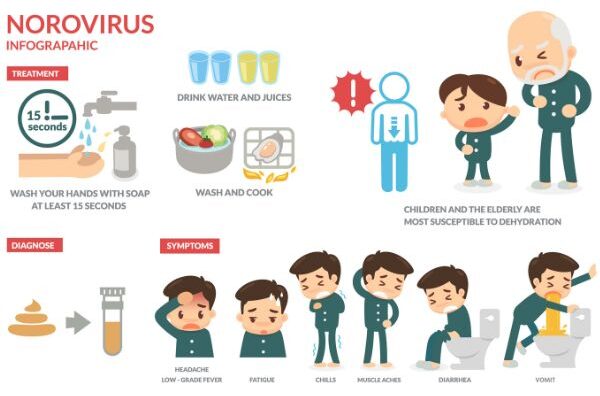 Symptoms, diagnosis, and prevention of norovirus infection