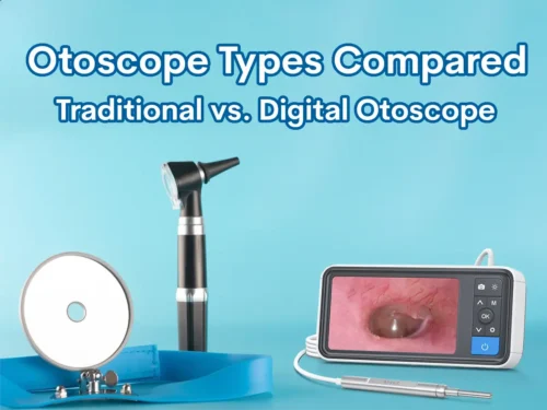 Otoscope Types Compared: Traditional vs. Digital Otoscopes