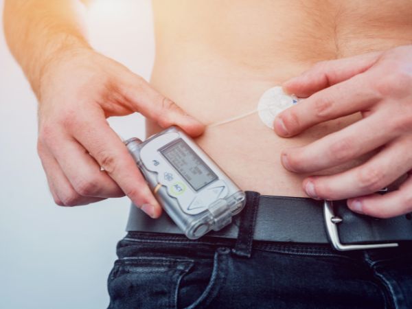Insulin pumps help deliver pre-set insulin doses to the diabetic patient