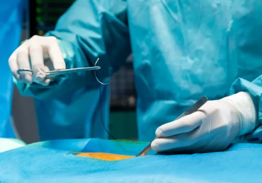Non-absorbable sutures need removal once the wound is healed