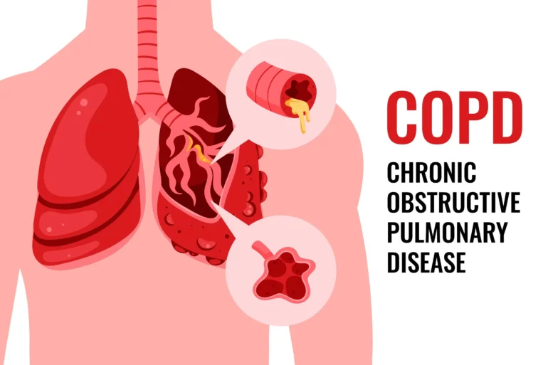 Diseases like COPD increase mucus production which leads to obstructed breathing