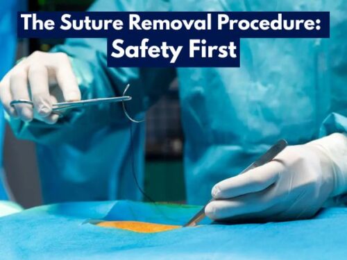 The Suture Removal Procedure: Safety First