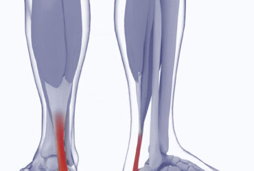 C3 POST OP SHOE W/MICROBAN MENS BL MD