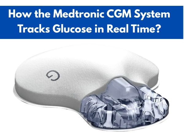 How the Medtronic CGM System Tracks Glucose in Real Time?